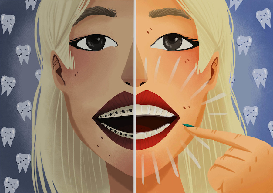 Graphic illustration of woman comparing metal braces and clear aligners